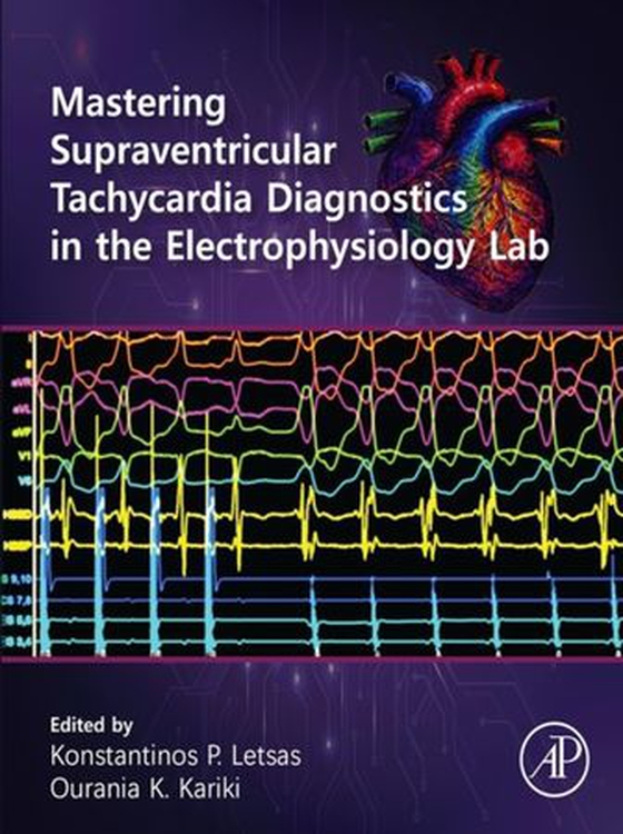 Mastering Supraventricular Tachycardia Diagnostics in the Electrophysiology Lab