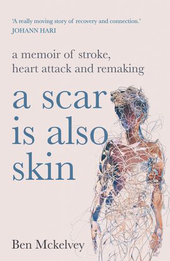 A Scar is Also Skin - A memoir of stroke, heart attack and remaking (ebok) av Ben Mckelvey