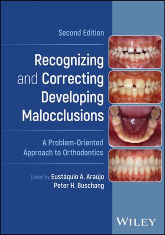 Recognizing and Correcting Developing Malocclusions - A Problem-Oriented Approach to Orthodontics (ebok) av -