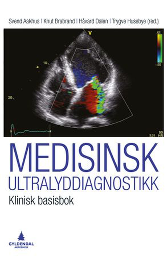 Medisinsk ultralyddiagnostikk